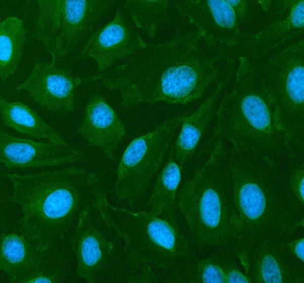 a02691 2 cyp26b1 primary antibodies if testing 1 a02691 2 cyp26b1 primary antibodies if testing 1