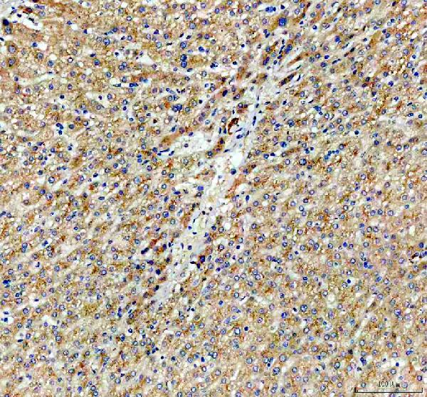 a02691 2 cyp26b1 primary antibodies ihc testing 1 a02691 2 cyp26b1 primary antibodies ihc testing 1