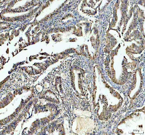 a04375 1 psme3 primary antibodies ihc testing 2 a04375 1 psme3 primary antibodies ihc testing 2