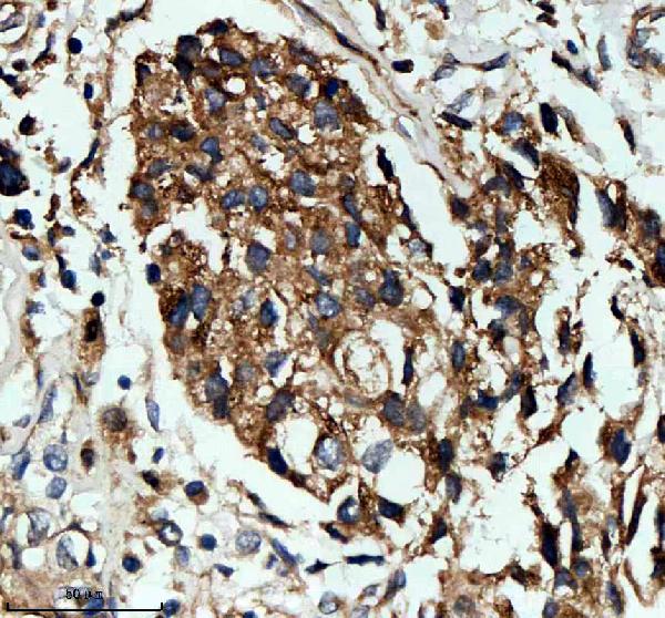 a05621 nid1 primary antibodies ihc testing 1 a05621 nid1 primary antibodies ihc testing 1