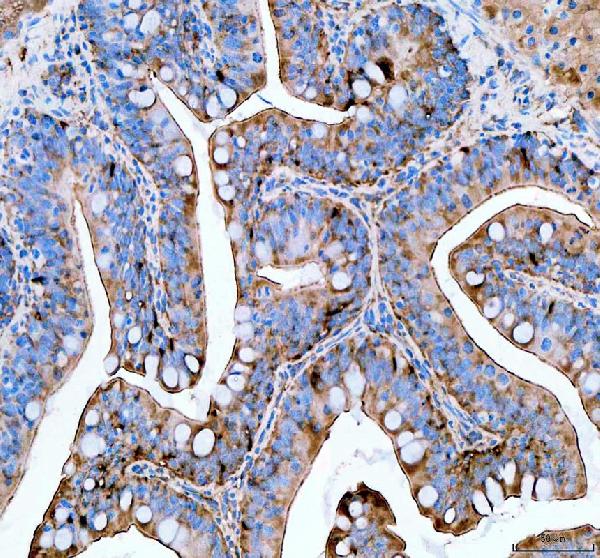 azb0r1d0 psmc4 primary antibodies ihc testing 2 azb0r1d0 psmc4 primary antibodies ihc testing 2