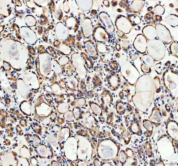a02691 2 cyp26b1 primary antibodies ihc testing 2 a02691 2 cyp26b1 primary antibodies ihc testing 2