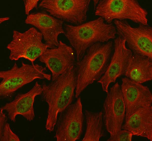 a04375 1 psme3 primary antibodies if testing 1 a04375 1 psme3 primary antibodies if testing 1