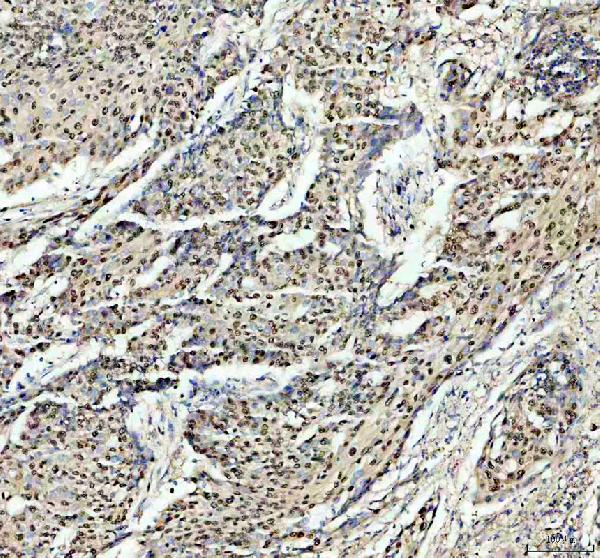 a04375 1 psme3 primary antibodies ihc testing 1 a04375 1 psme3 primary antibodies ihc testing 1